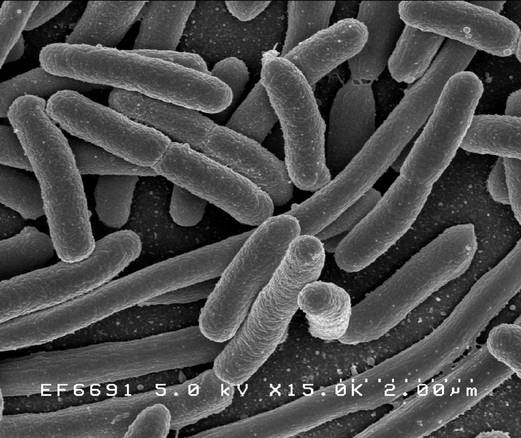 Bacteris resistents als antibiòtics: l'amenaça fantasma!