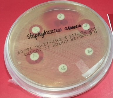 Bacteris resistents als antibiòtics: la pandèmia silenciosa!