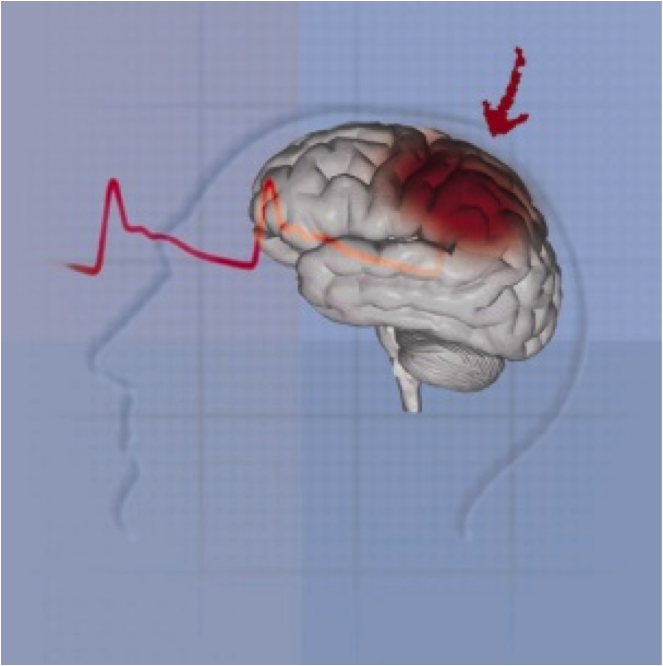 Setmana del Cervell 2022: Accidents de trànsit i traumatismes cranials. Causes i conseqüències